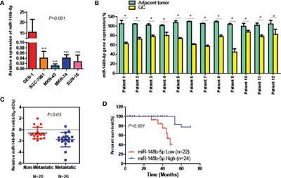 Targeting miR-148b-5p Inhibits Immunity Microenvironment and Gastric Cancer Progression